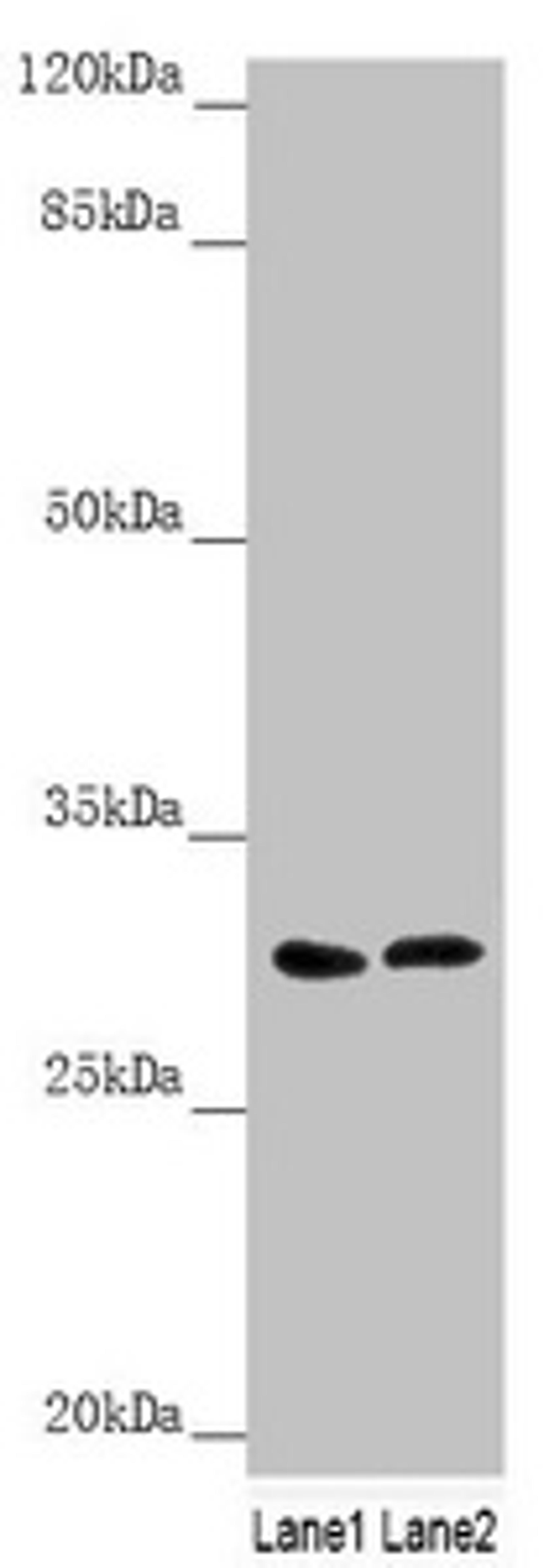 Western blot. All lanes: SNAP29 antibody at 1.79µg/ml. Lane 1: 293T whole cell lysate. Lane 2: Jurkat whole cell lysate. Secondary. Goat polyclonal to rabbit IgG at 1/10000 dilution. Predicted band size: 29 kDa. Observed band size: 29 kDa