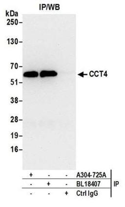 Detection of human CCT4 by western blot of immunoprecipitates.