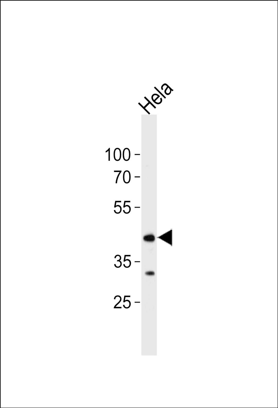 Western blot analysis of lysate from Hela cell line, using JNK1 antibody at 1:1000 at each lane.