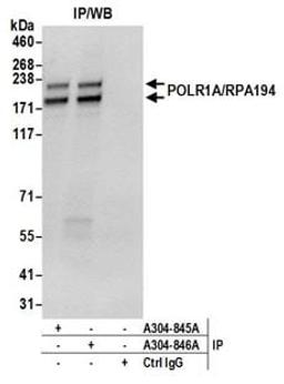 Detection of human POLR1A/RPA194 by western blot of immunoprecipitates.