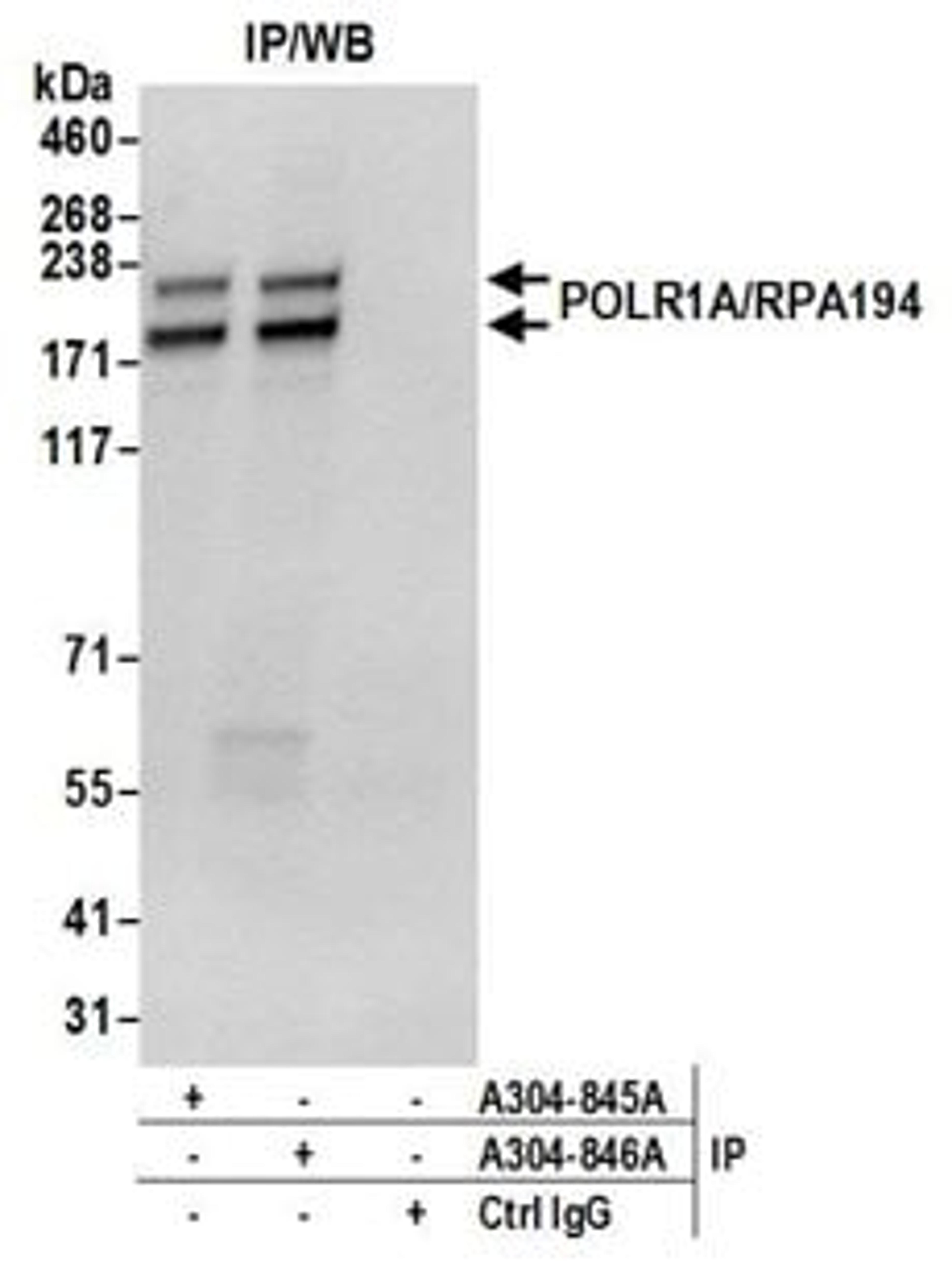 Detection of human POLR1A/RPA194 by western blot of immunoprecipitates.