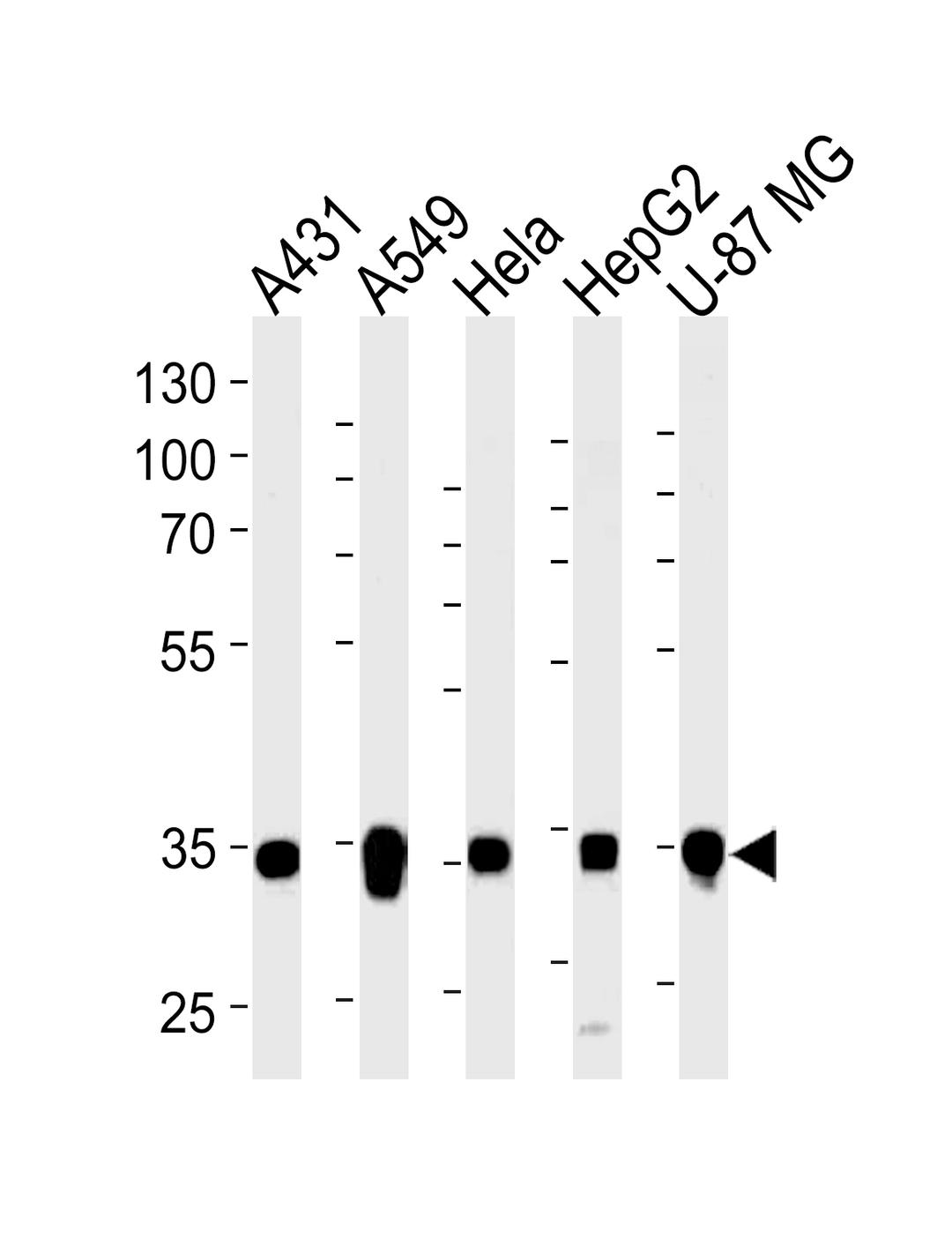 Western blot analysis of lysates from A431, A549, Hela, HepG2, U-87 MG cell line (from left to right), using MDH2 Antibody at 1:1000 at each lane.