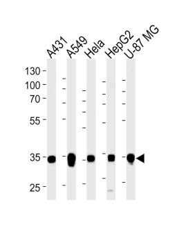 Western blot analysis of lysates from A431, A549, Hela, HepG2, U-87 MG cell line (from left to right), using MDH2 Antibody at 1:1000 at each lane.