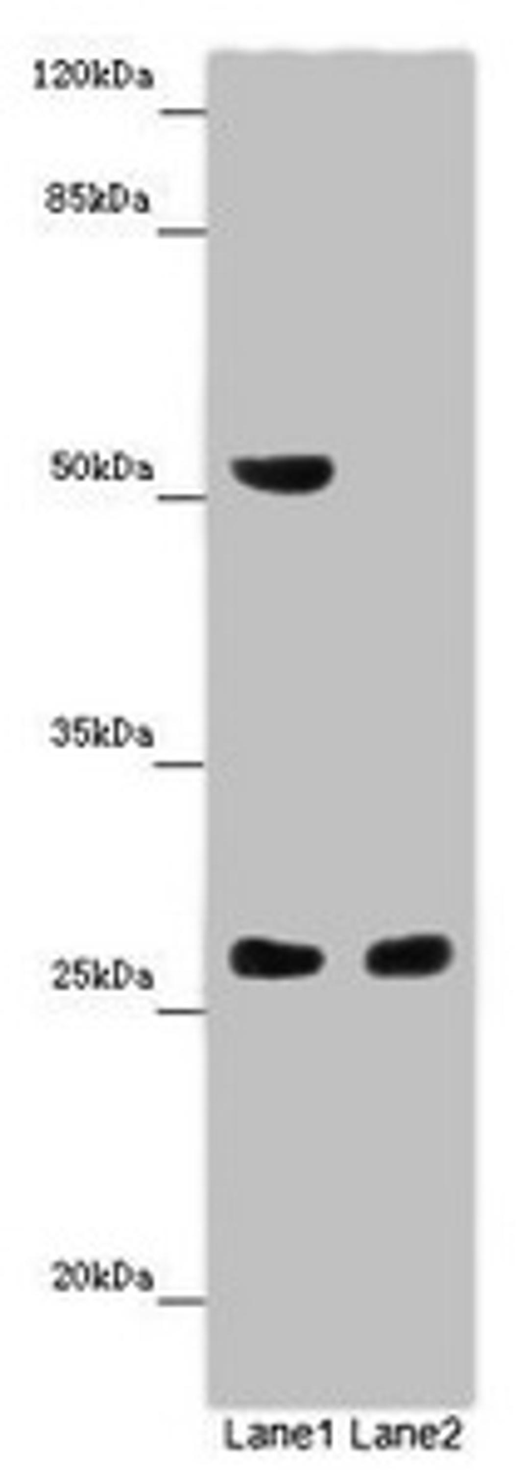 Western blot. All lanes: CHTOP antibody at 14 ug/ml. Lane 1: Mouse heart tissue. Lane 2: Mouse kidney tissue. Secondary. Goat polyclonal to rabbit IgG at 1/10000 dilution. Predicted band size: 27, 22 kDa. Observed band size: 27, 52 kDa.
