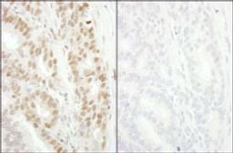 Detection of human Phospho-MCM2 (S53) by immunohistochemistry.