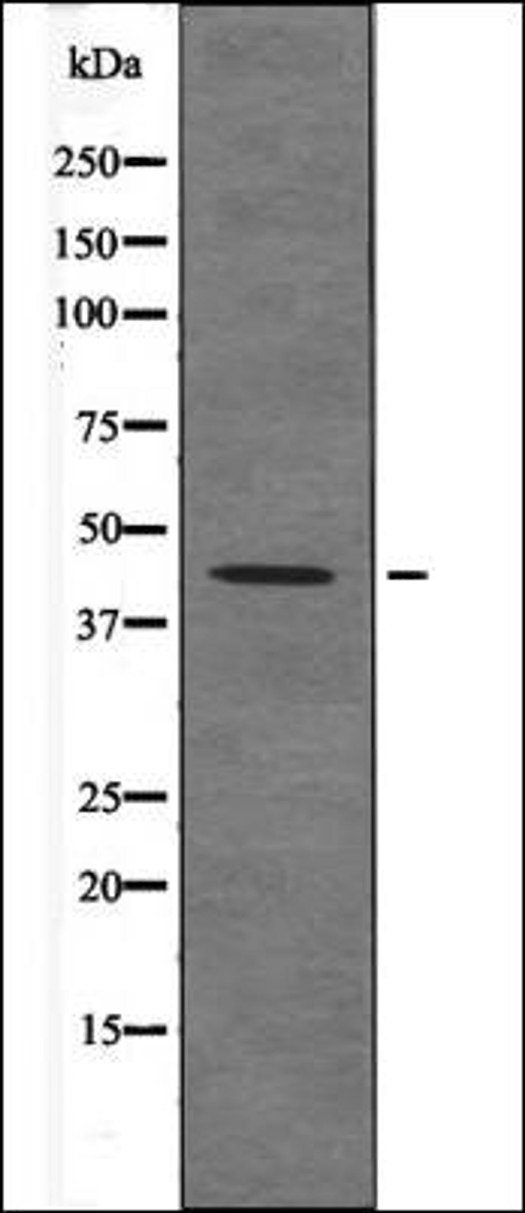 Western blot analysis of P Rat kidneytissue lysates using Connexin 43 -Phospho-Ser373- antibody