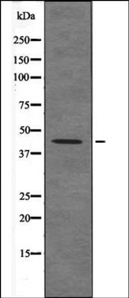 Western blot analysis of P Rat kidneytissue lysates using Connexin 43 -Phospho-Ser373- antibody