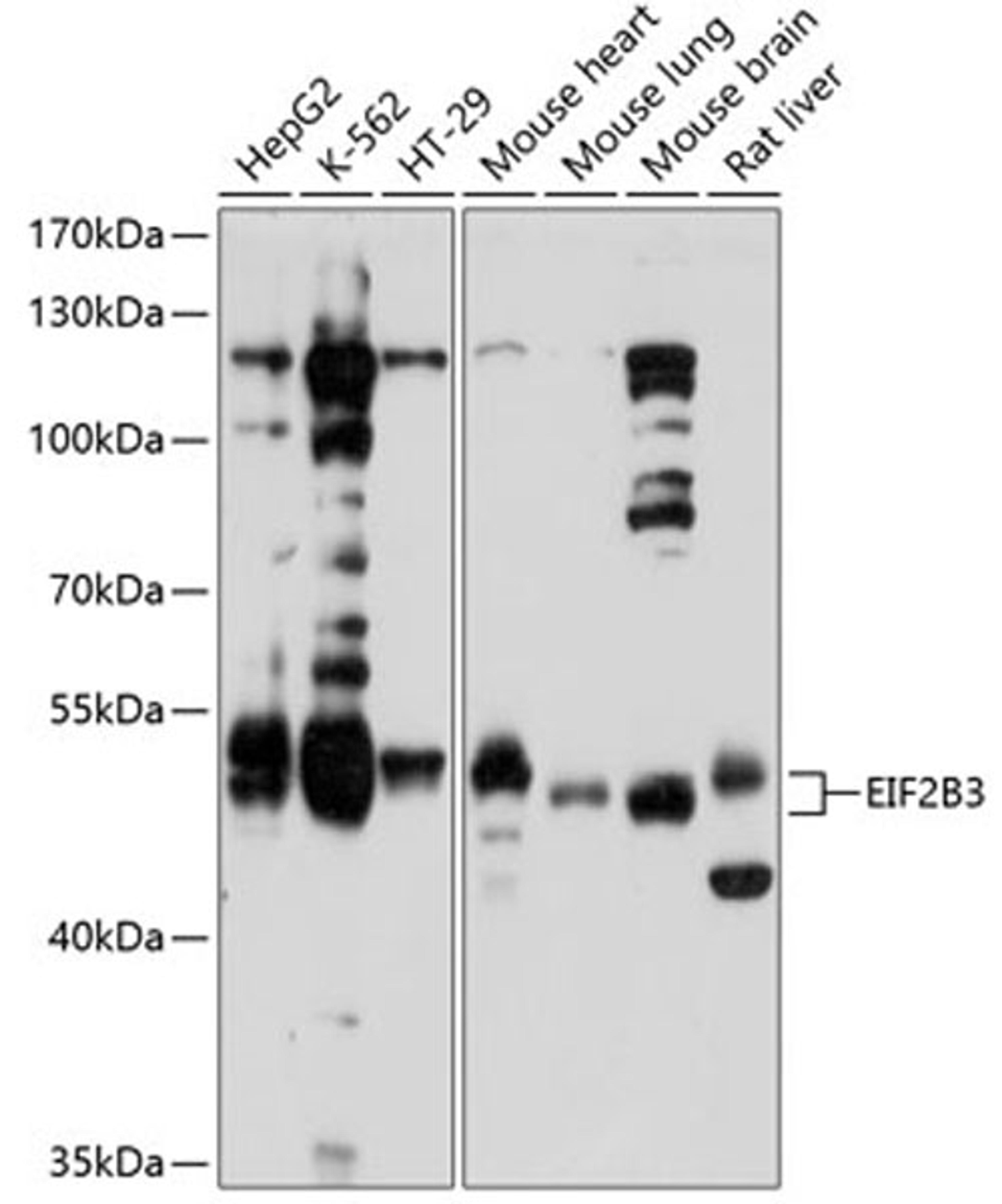 Western blot - EIF2B3 antibody (A10262)