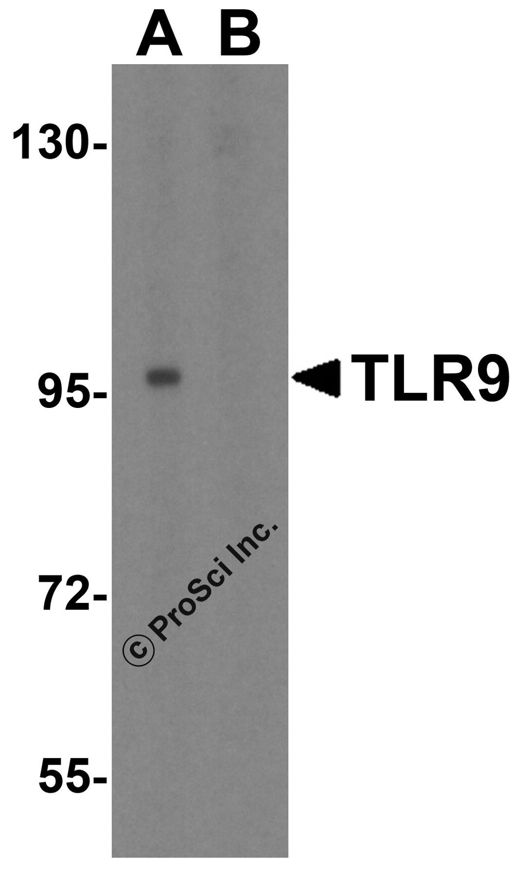 Western blot analysis of TLR9 in Jurkat cell lysate with TLR9 antibody at 1 μg/mL in (A) the absence and (B) the presence of blocking peptide