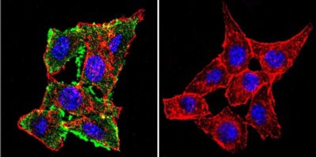 Immunocytochemistry/Immunofluorescence: CFTR Antibody (CF3) [NB300-511] - CFTR staining (green), F-Actin staining with Phalloidin (red) and nuclei with DAPI (blue) is shown. Cells were grown on chamber slides and fixed with formaldehyde prior to staining. Cells were probed without (control) or with or an antibody recognizing CFTR at a dilution of 1:100-1:200 over night at 4C, washed with PBS and incubated with a DyLight-488 conjugated.