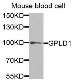 Western blot analysis of extracts of mouse blood cells using GPLD1 antibody