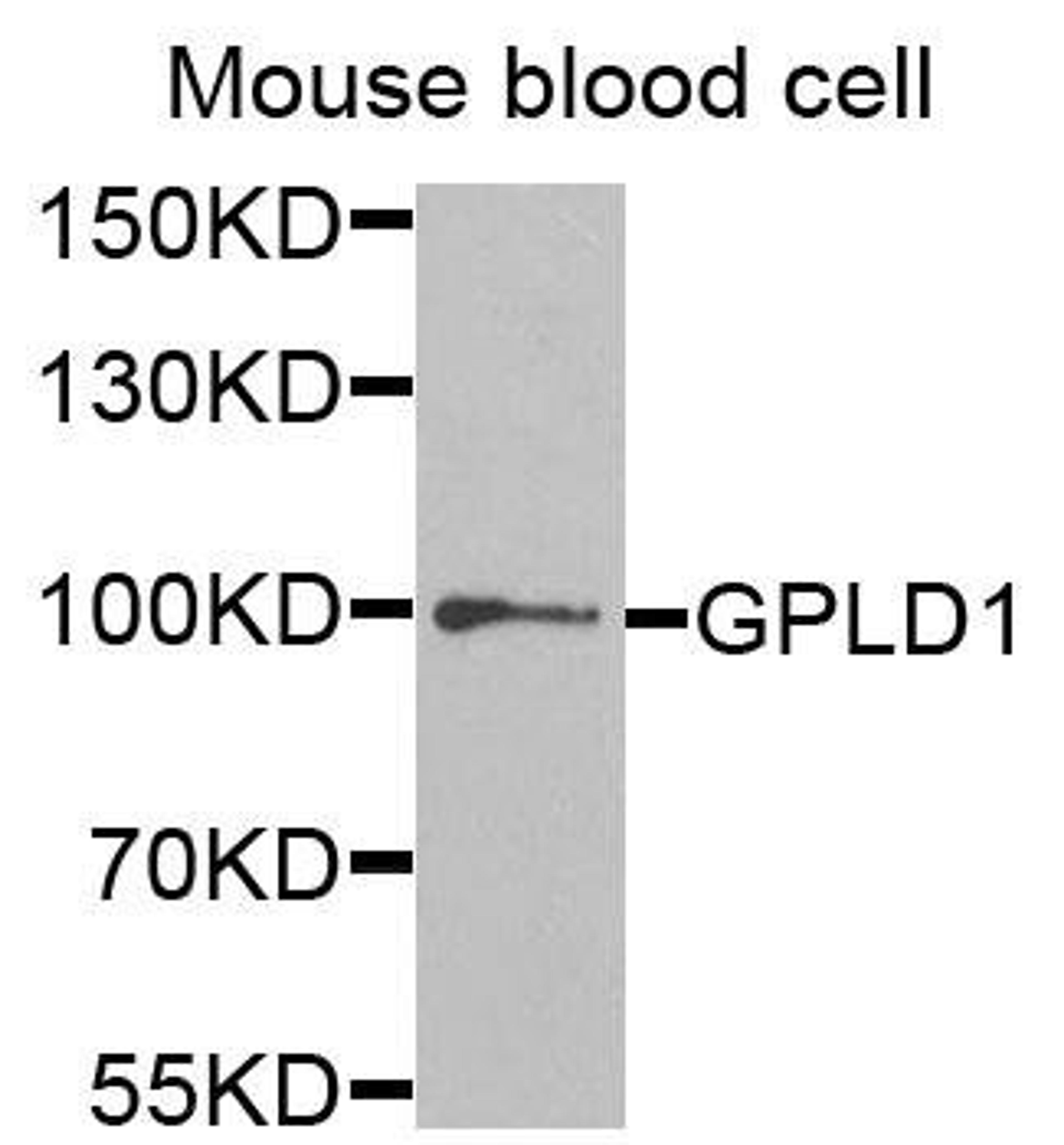 Western blot analysis of extracts of mouse blood cells using GPLD1 antibody