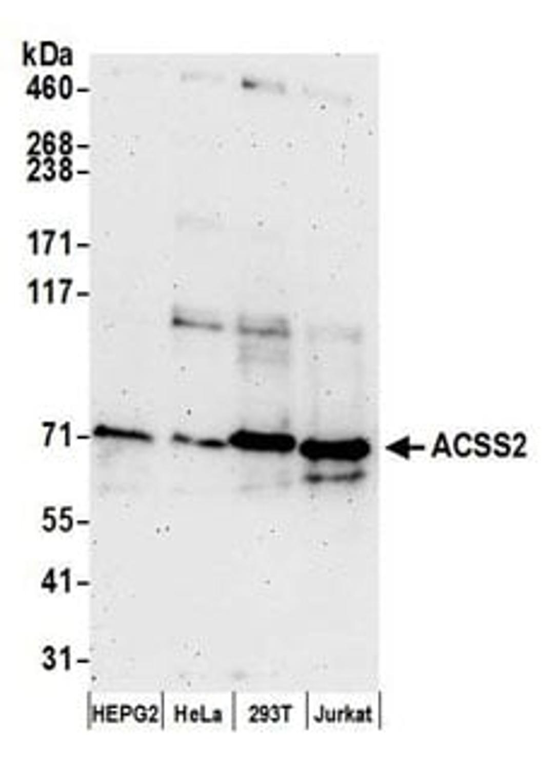 Detection of human ACSS2 by western blot.