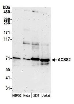 Detection of human ACSS2 by western blot.