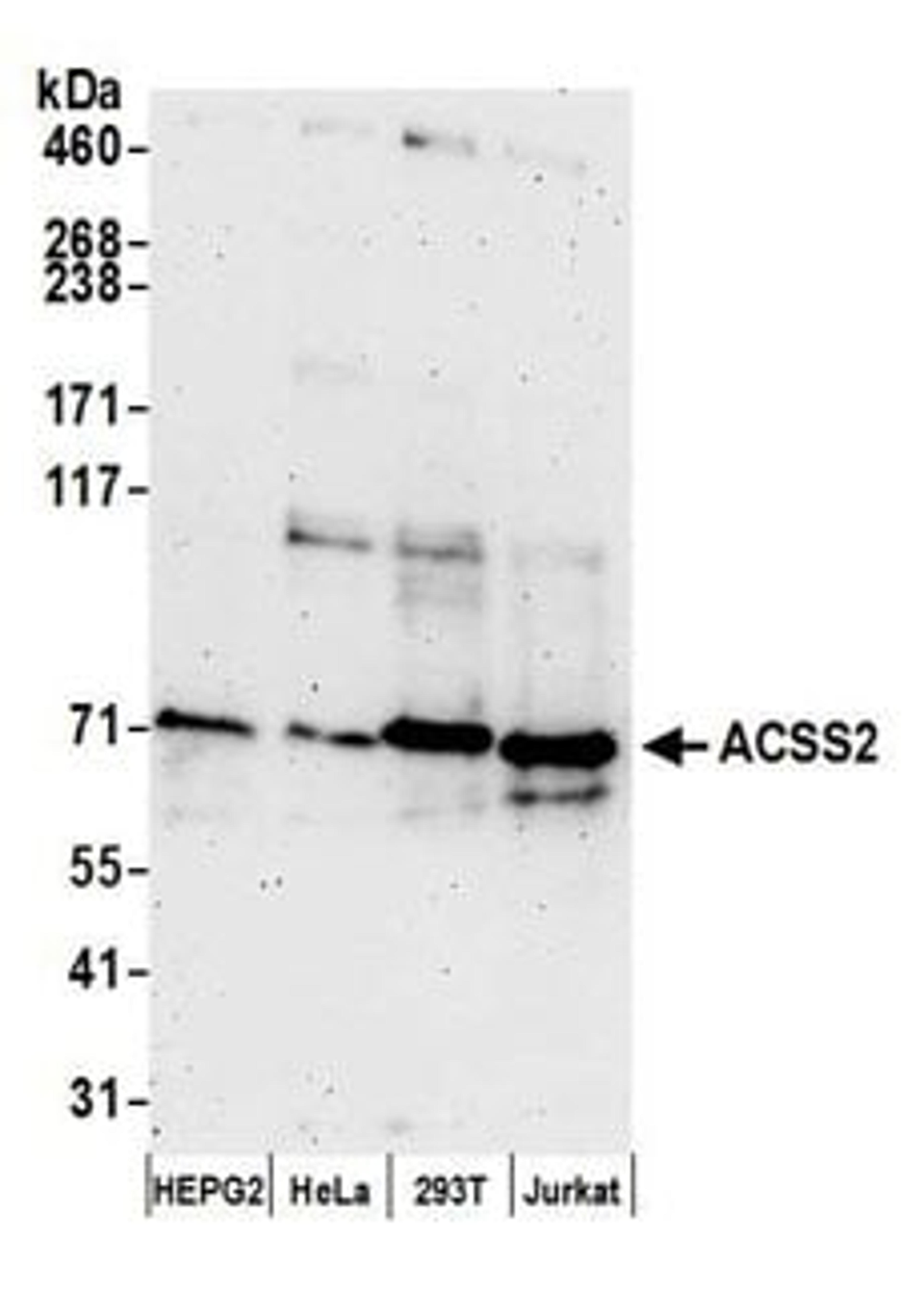 Detection of human ACSS2 by western blot.