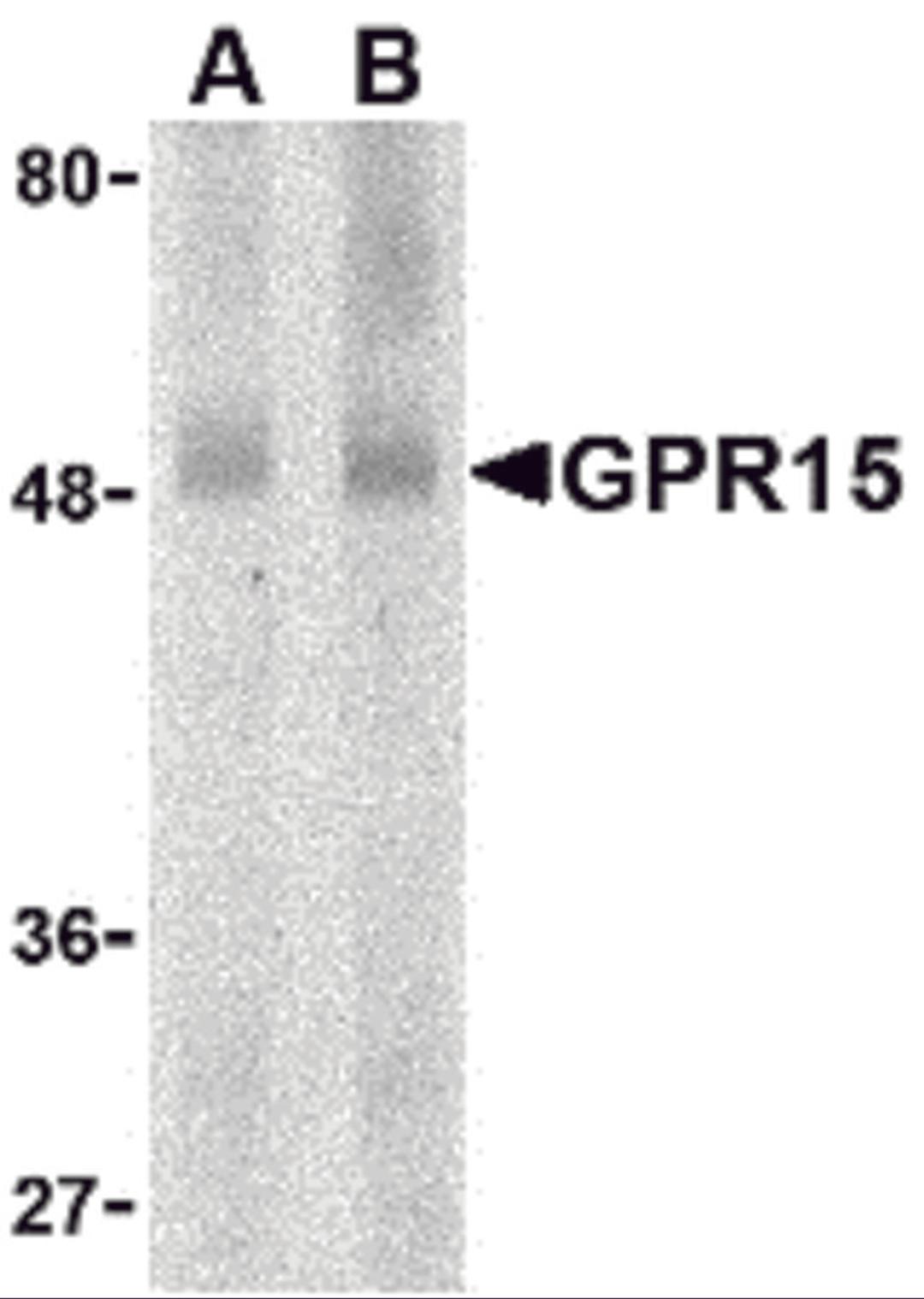 Western blot analysis of GPR15 in human spleen lysate with GPR15 antibody at (A) 0.5 and (B) 1 μg/mL.