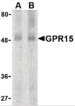 Western blot analysis of GPR15 in human spleen lysate with GPR15 antibody at (A) 0.5 and (B) 1 μg/mL.