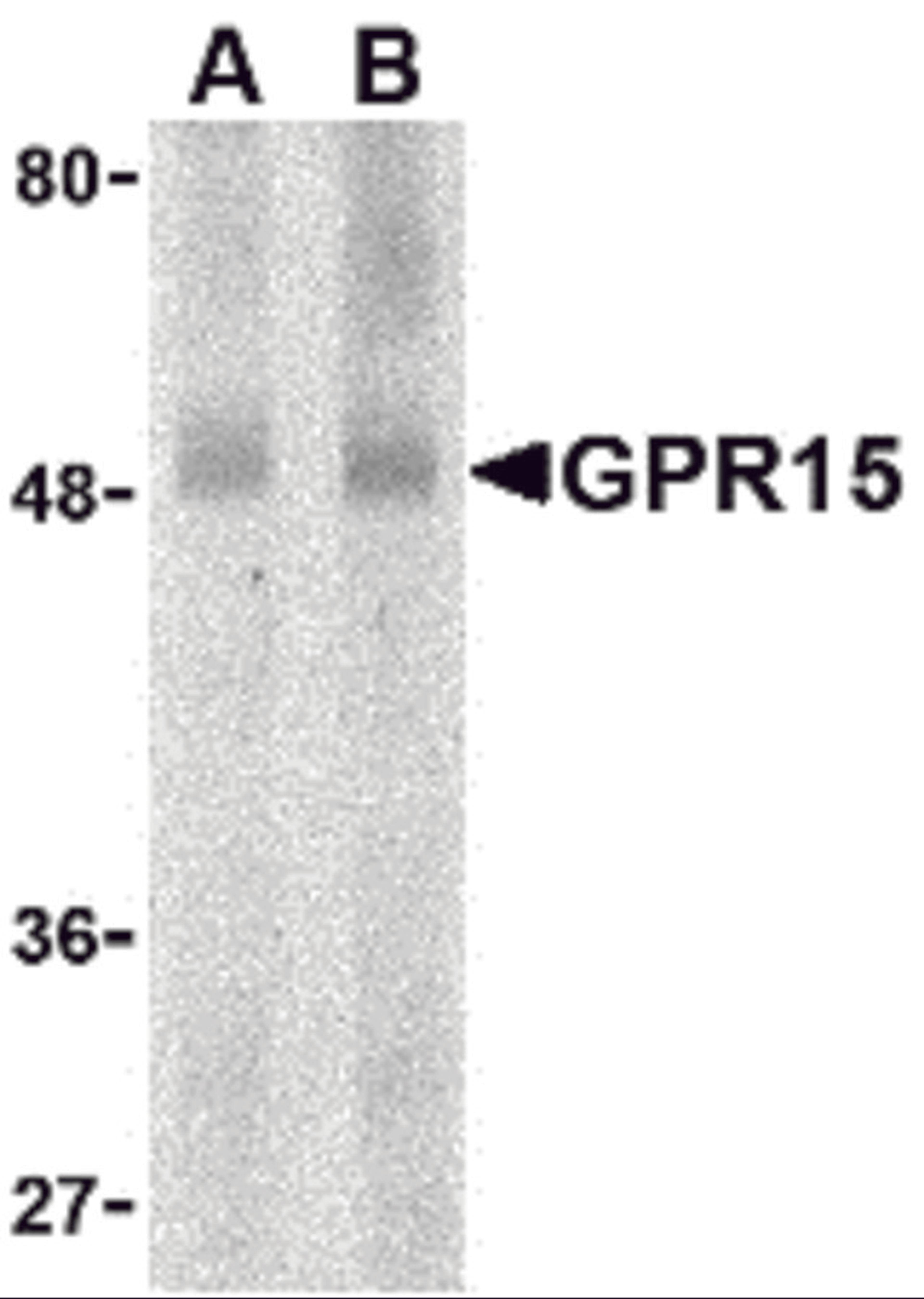 Western blot analysis of GPR15 in human spleen lysate with GPR15 antibody at (A) 0.5 and (B) 1 μg/mL.