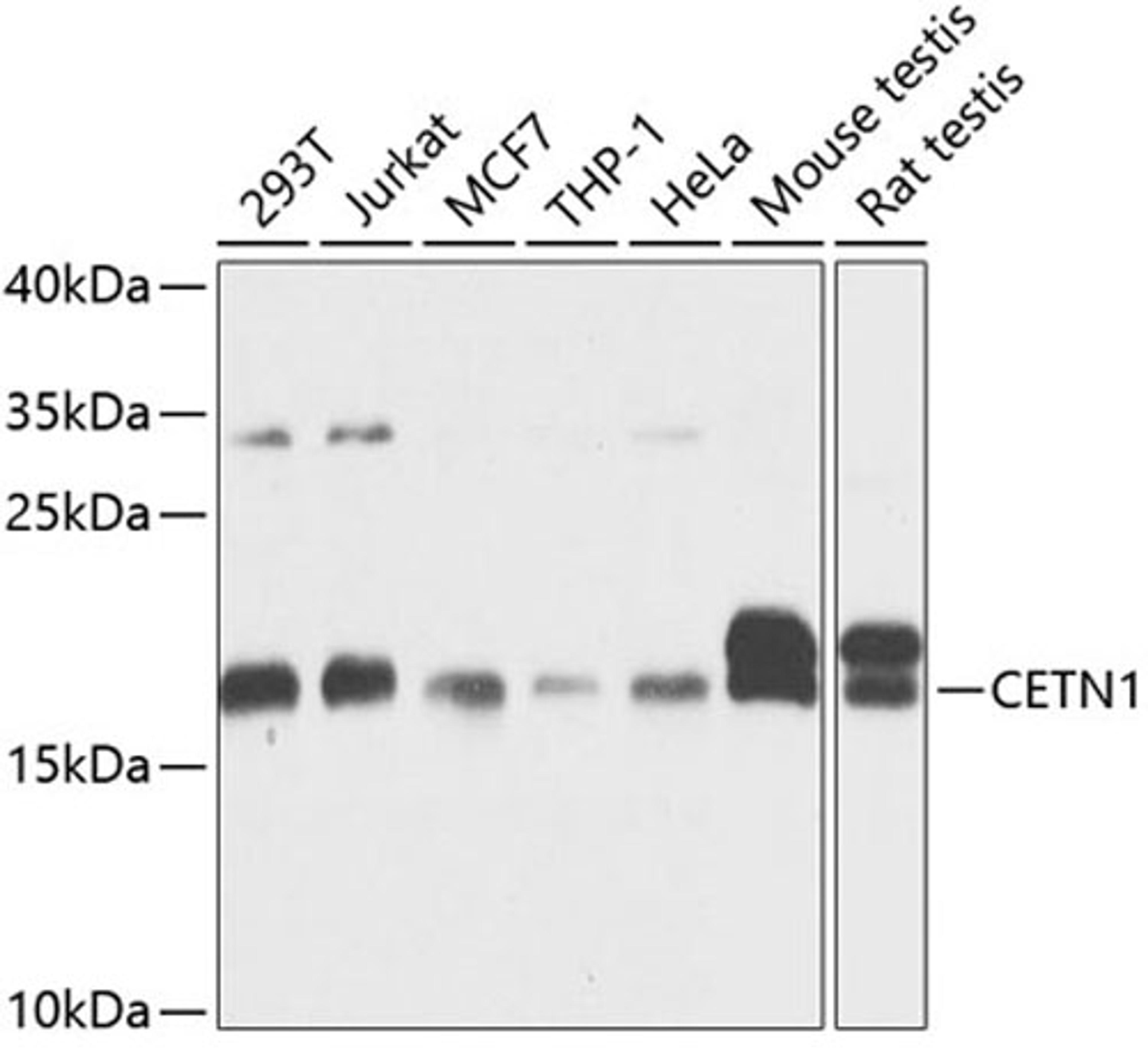 Western blot - CETN1 antibody (A3784)