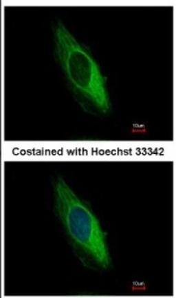 Immunocytochemistry/Immunofluorescence: Cytokeratin 6b Antibody [NBP2-14924] - Analysis of methanol-fixed HeLa, using antibody at 1:500 dilution.