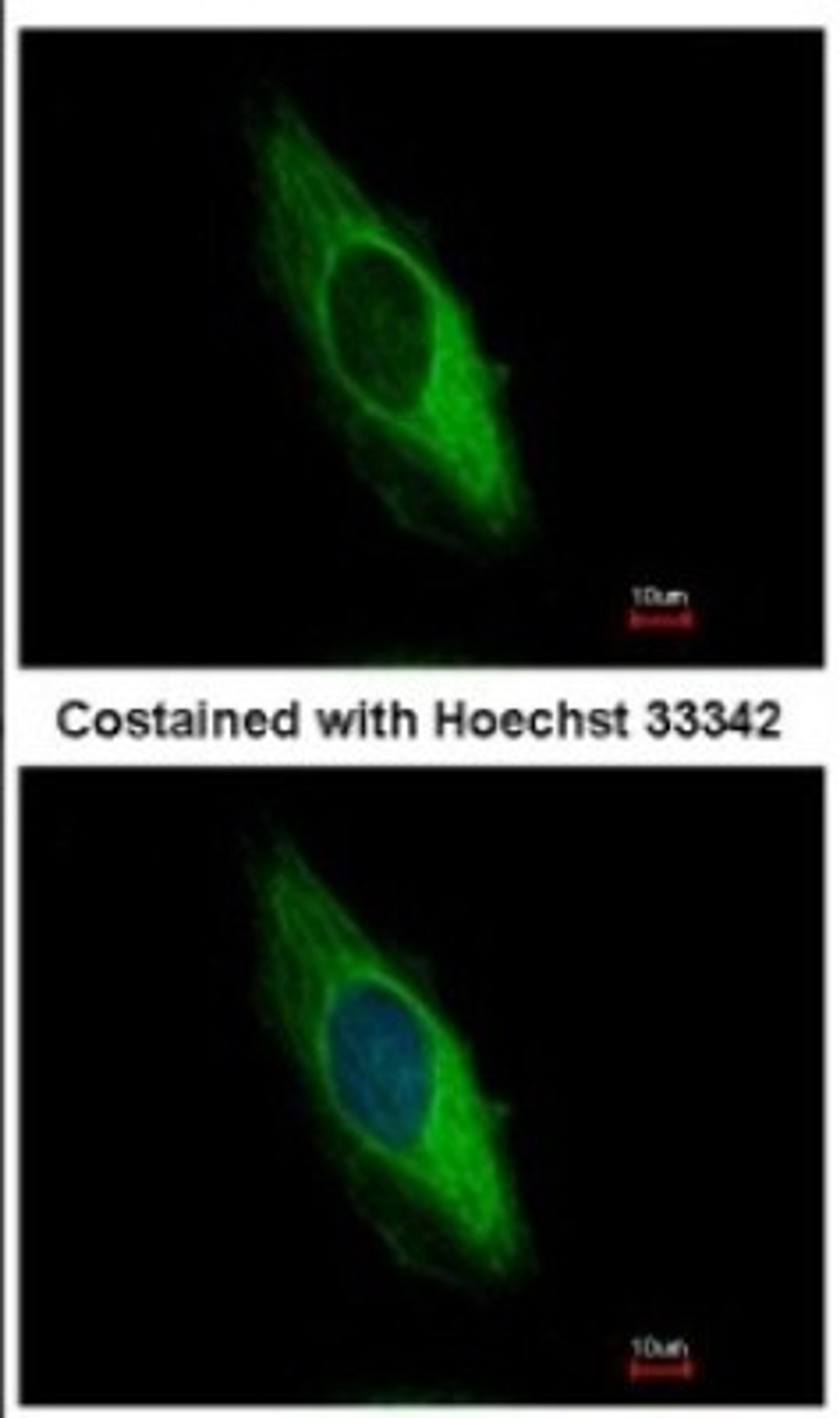 Immunocytochemistry/Immunofluorescence: Cytokeratin 6b Antibody [NBP2-14924] - Analysis of methanol-fixed HeLa, using antibody at 1:500 dilution.