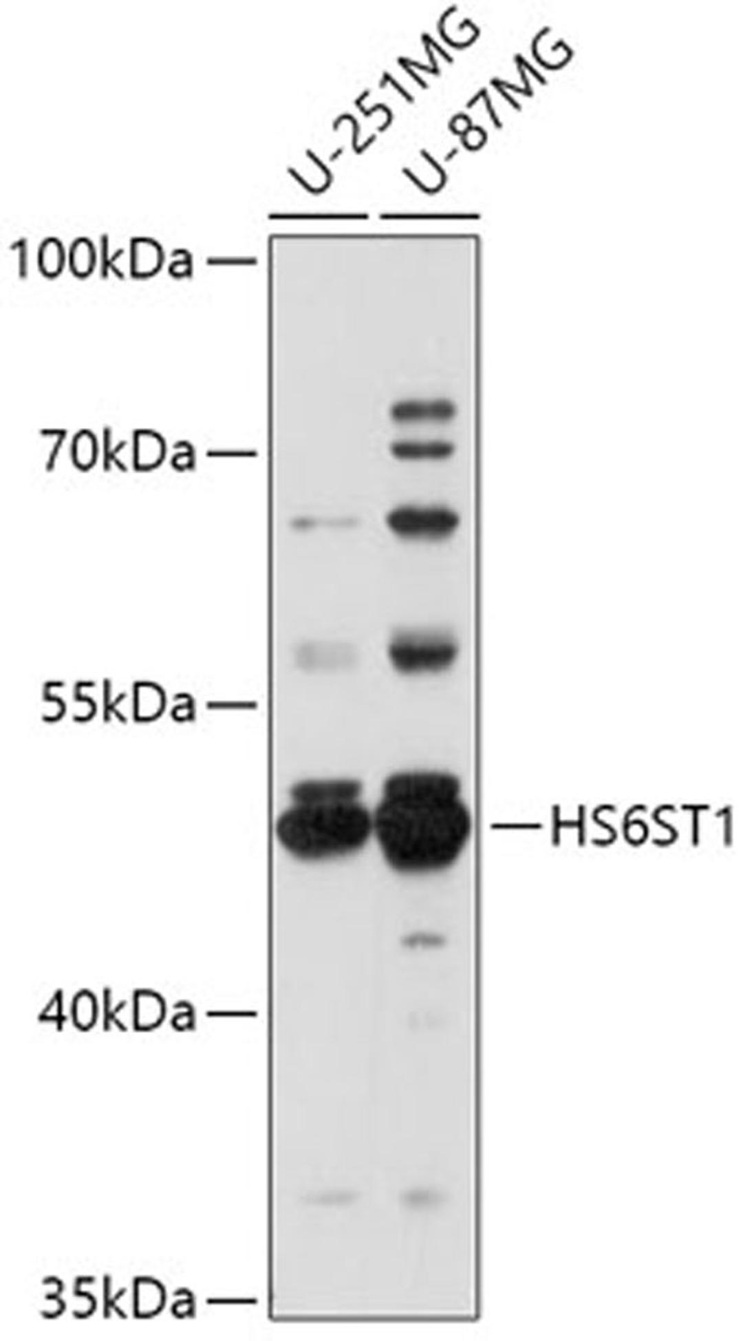 Western blot - HS6ST1 antibody (A17595)