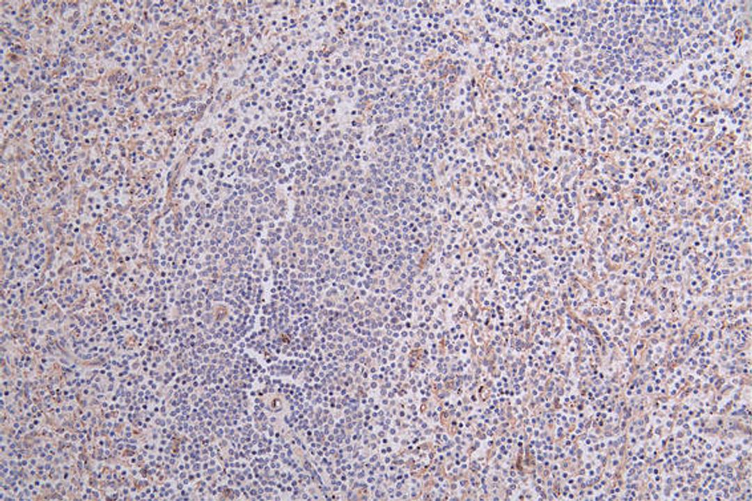 IHC image of CSB-RA097934A0HU diluted at 1:100 and staining in paraffin-embedded human spleen tissue performed on a Leica BondTM system. After dewaxing and hydration, antigen retrieval was mediated by high pressure in a citrate buffer (pH 6.0). Section was blocked with 10% normal goat serum 30min at RT. Then primary antibody (1% BSA) was incubated at 4°C overnight. The primary is detected by a Goat anti-rabbit polymer IgG labeled by HRP and visualized using 0.25% DAB.