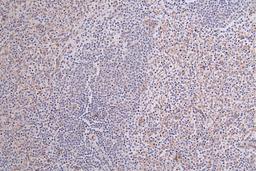 IHC image of CSB-RA097934A0HU diluted at 1:100 and staining in paraffin-embedded human spleen tissue performed on a Leica BondTM system. After dewaxing and hydration, antigen retrieval was mediated by high pressure in a citrate buffer (pH 6.0). Section was blocked with 10% normal goat serum 30min at RT. Then primary antibody (1% BSA) was incubated at 4°C overnight. The primary is detected by a Goat anti-rabbit polymer IgG labeled by HRP and visualized using 0.25% DAB.