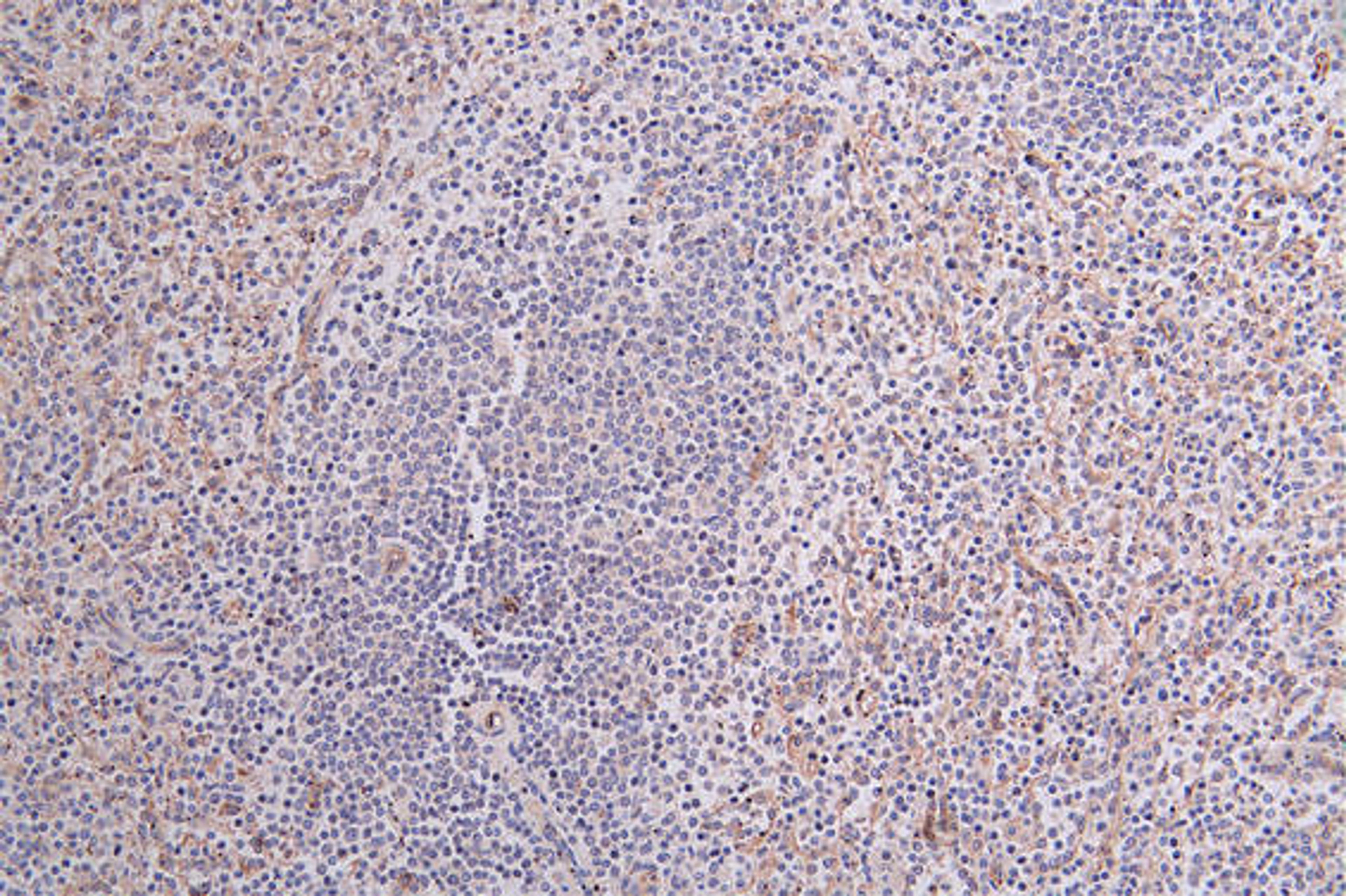 IHC image of CSB-RA097934A0HU diluted at 1:100 and staining in paraffin-embedded human spleen tissue performed on a Leica BondTM system. After dewaxing and hydration, antigen retrieval was mediated by high pressure in a citrate buffer (pH 6.0). Section was blocked with 10% normal goat serum 30min at RT. Then primary antibody (1% BSA) was incubated at 4°C overnight. The primary is detected by a Goat anti-rabbit polymer IgG labeled by HRP and visualized using 0.25% DAB.