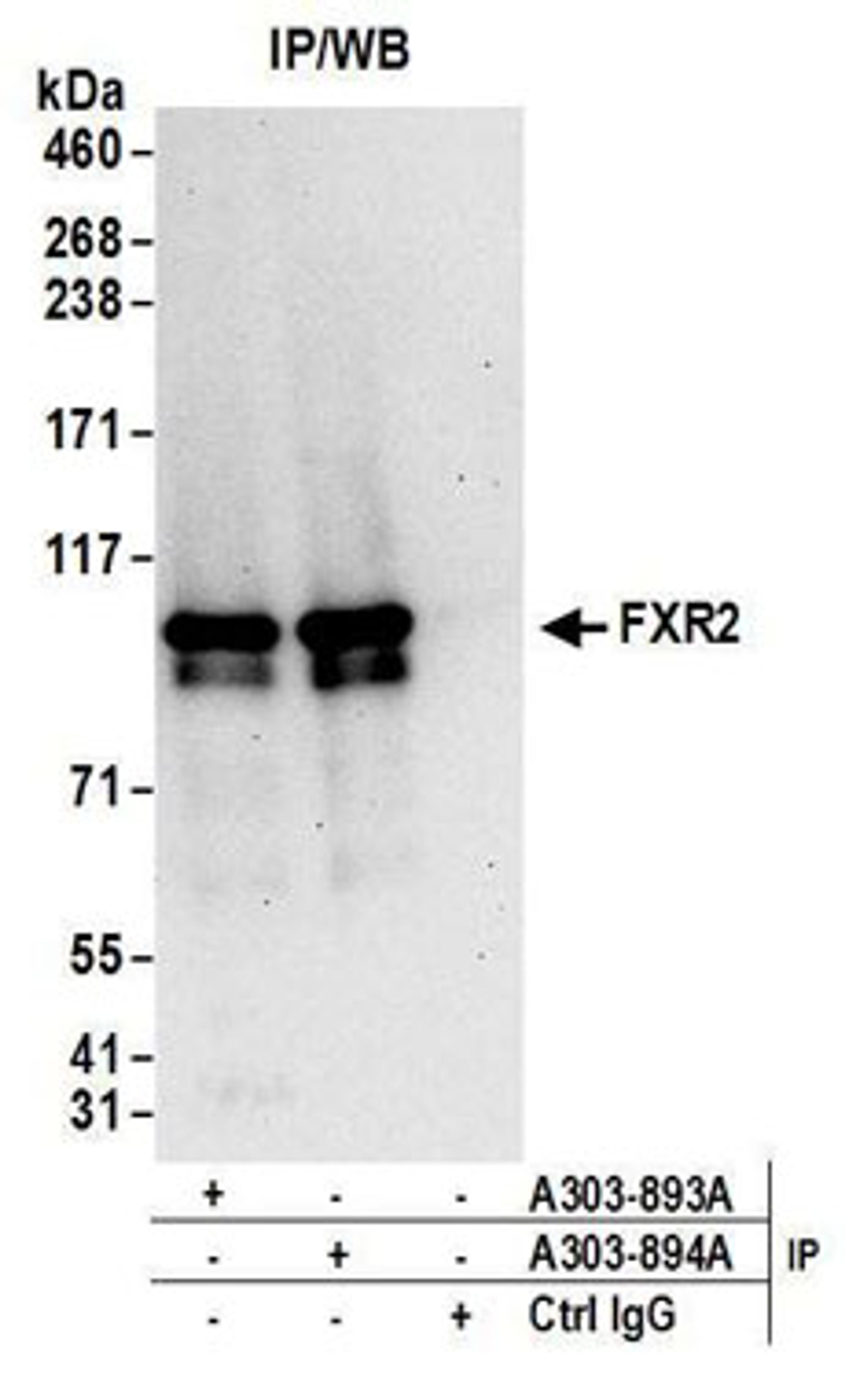 Detection of human FXR2 by western blot of immunoprecipitates.