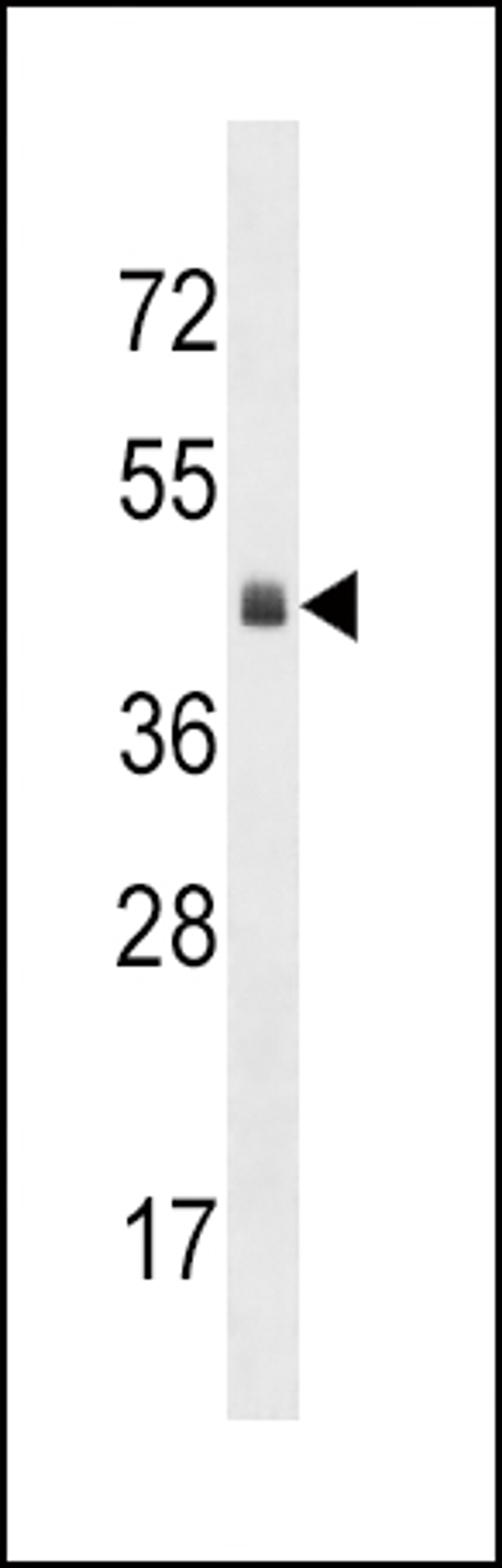 Western blot analysis in mouse heart tissue lysates (35ug/lane).