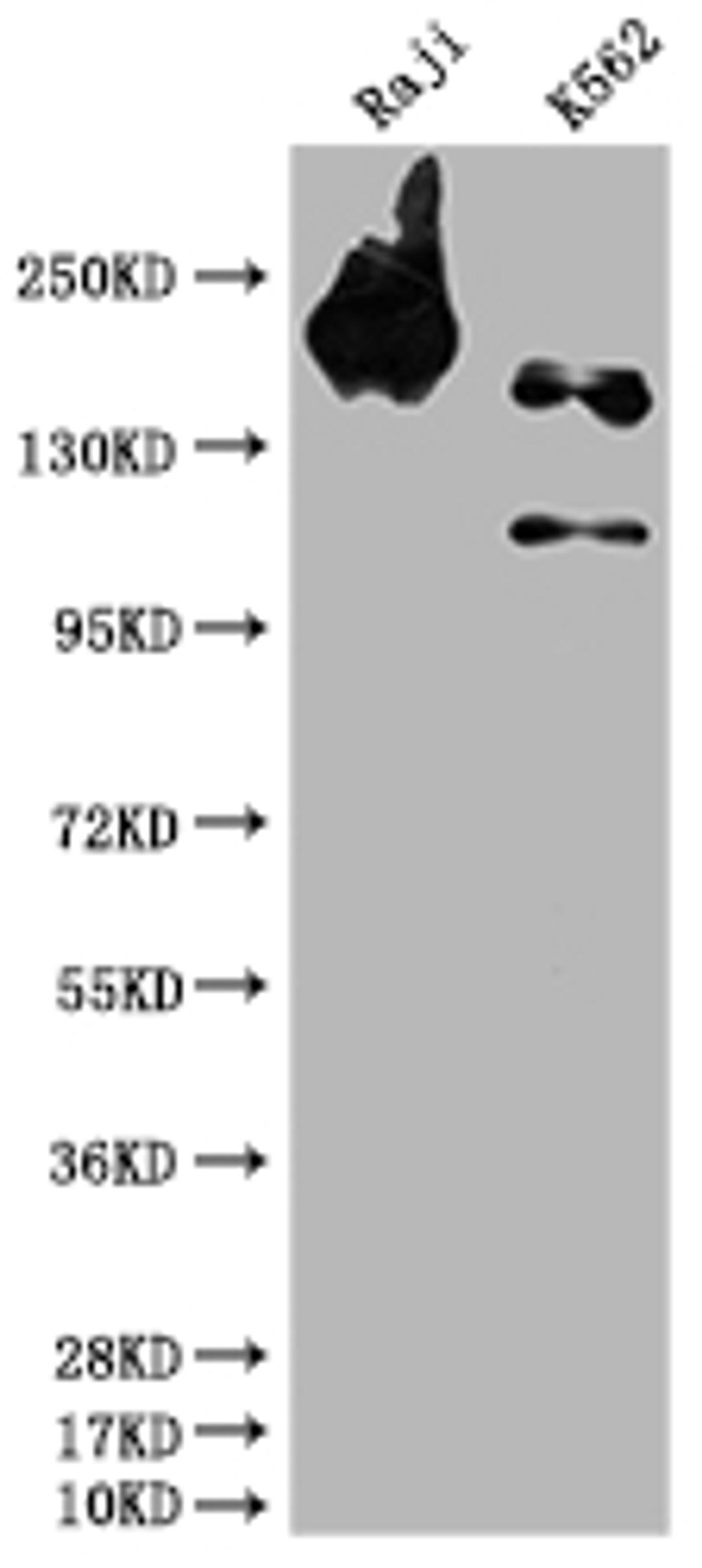 Western Blot. Positive WB detected in: Raji whole cell lysate, K562 whole cell lysate. All lanes: INPP5D antibody at 1:1500. Secondary. Goat polyclonal to rabbit IgG at 1/50000 dilution. Predicted band size: 134, 110 kDa. Observed band size: 145 kDa.
