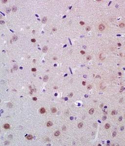 Immunohistochemical analysis of formalin fixed and paraffin embedded rat brain tissue using BRN3A antibody