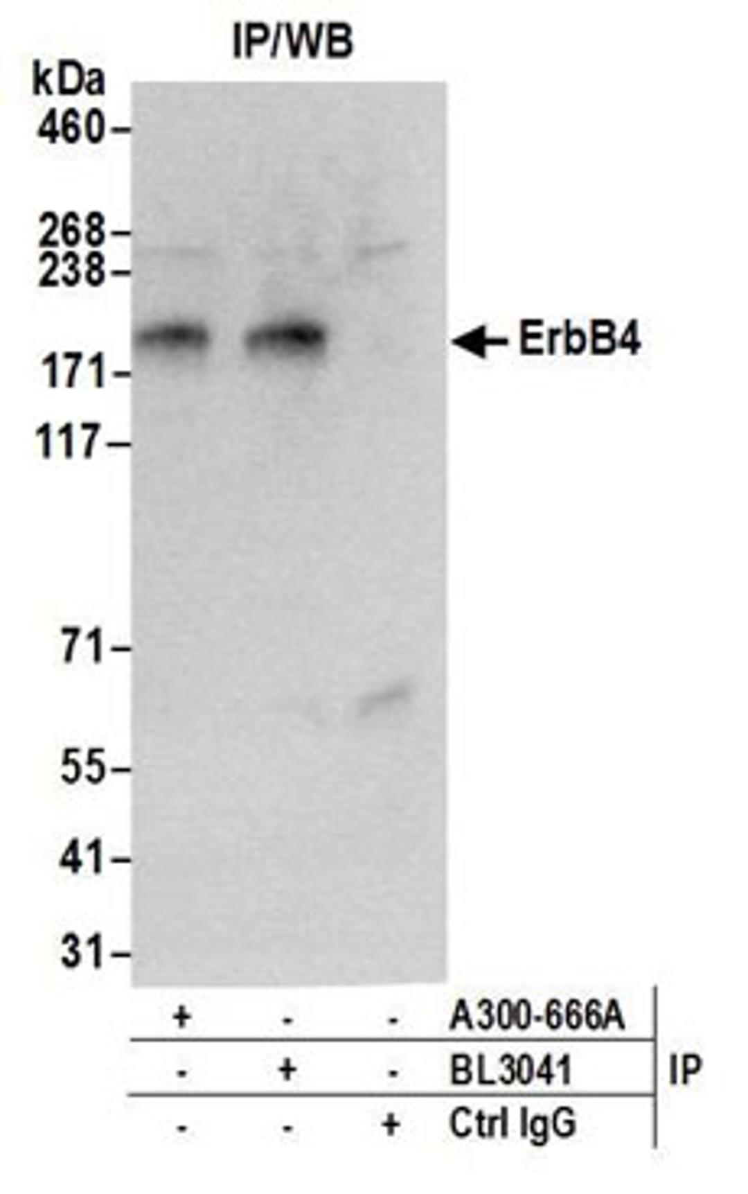 Detection of human ErbB4 by western blot of immunoprecipitates.