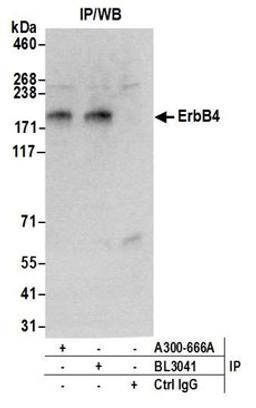 Detection of human ErbB4 by western blot of immunoprecipitates.