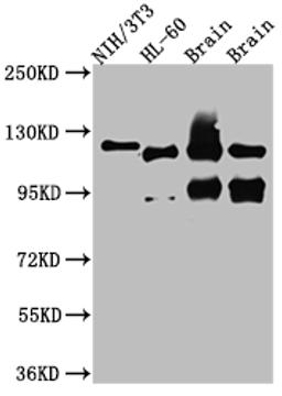 Western Blot. Positive WB detected in: NIH/3T3 whole cell lysate, HL-60 whole cell lysate, Rat Brain whole cell lysate, Mouse Brain whole cell lysate. All lanes: OGT antibody at 1:1000. Secondary. Goat polyclonal to rabbit IgG at 1/50000 dilution. Predicted band size: 117, 104, 116, 75 kDa. Observed band size: 117 kDa. 