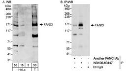 Western Blot: FANCI Antibody [NB100-60447] - Detection of Human FANCI on HeLa whole cell lysate using NB100-60447. FANCI was also immunoprecipitated, albeit less efficiently, by another rabbit anti-FANCI antibody.