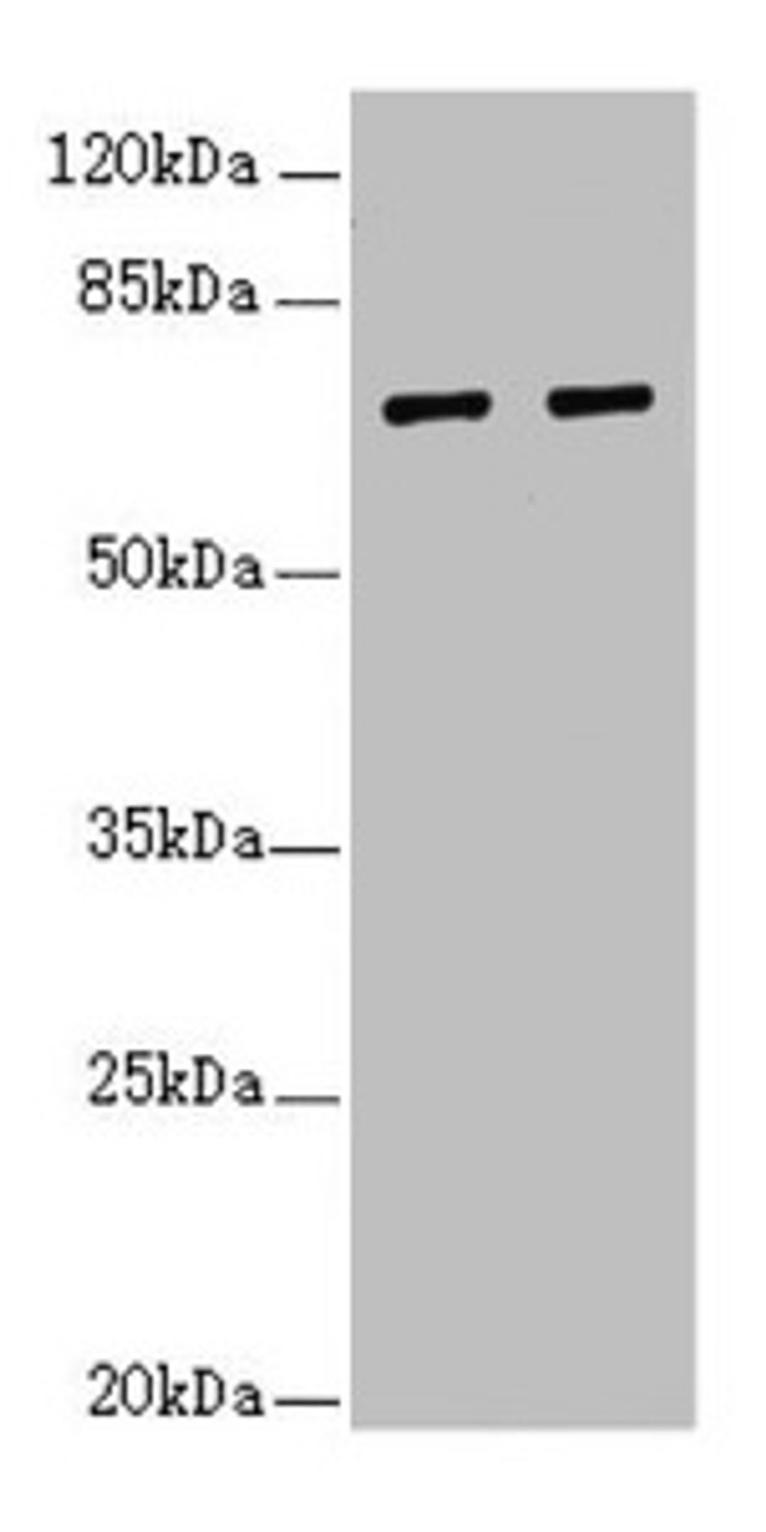 Western blot. All lanes: IWS1 antibody at 3.84µg/ml. Lane 1: 293T whole cell lysate. Lane 2: Jurkat whole cell lysate. Secondary. Goat polyclonal to rabbit IgG at 1/10000 dilution. Predicted band size: 92, 57, 70 kDa. Observed band size: 70 kDa