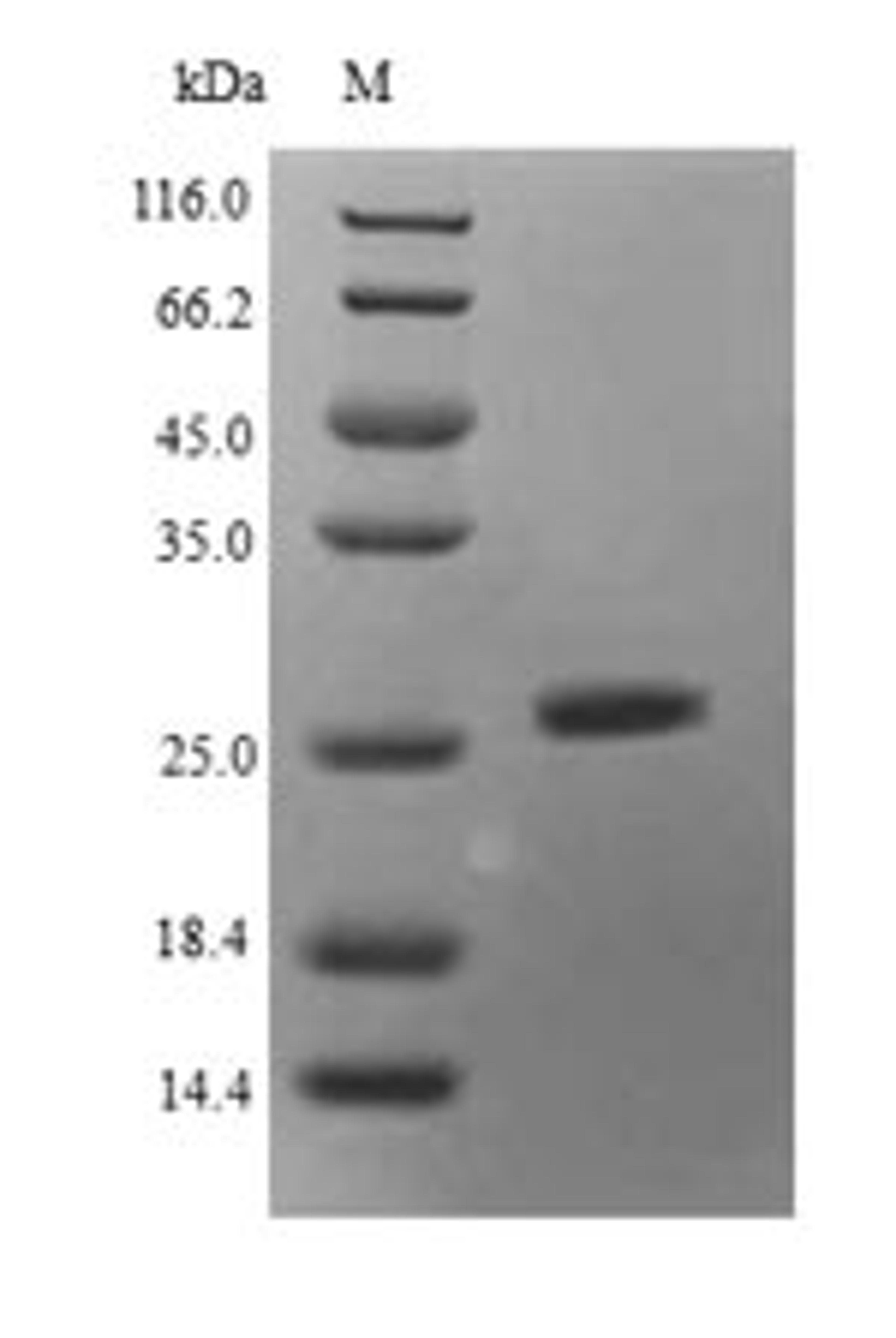 (Tris-Glycine gel) Discontinuous SDS-PAGE (reduced) with 5% enrichment gel and 15% separation gel.