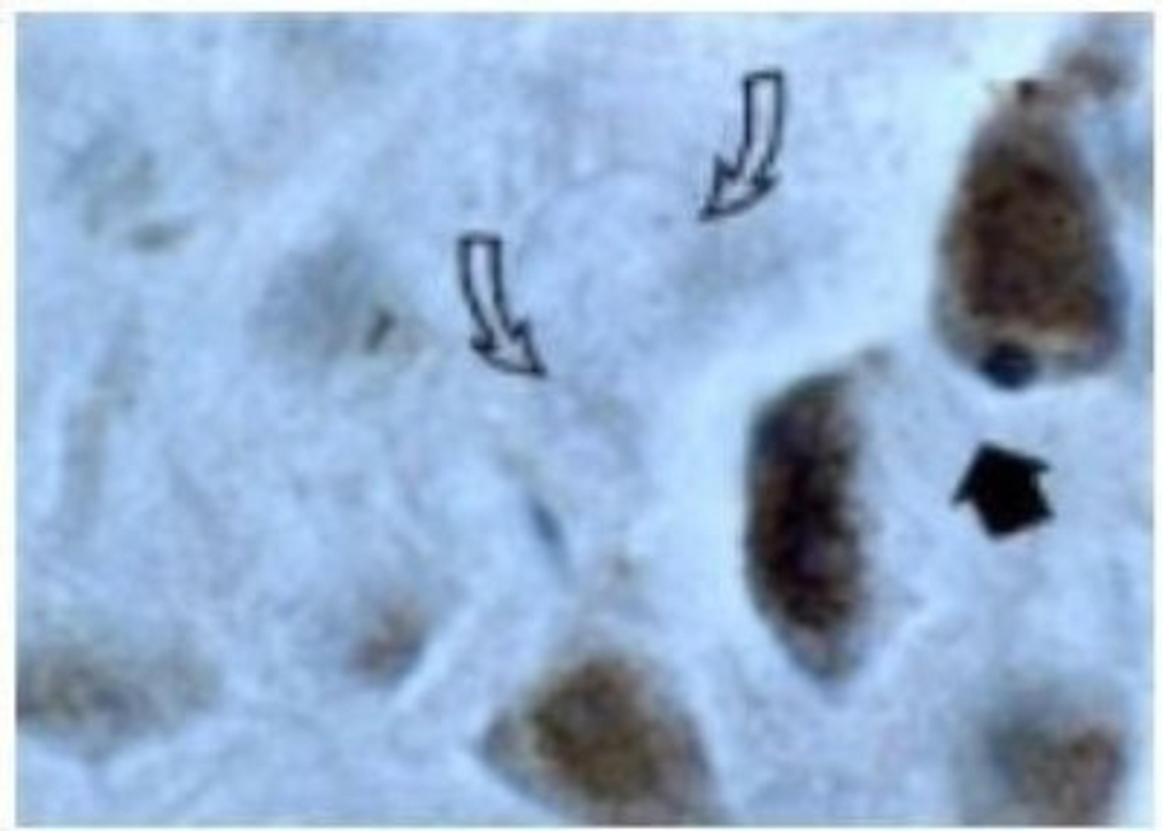 Immunohistochemistry-Paraffin: active/cleaved Caspase 3 Antibody [NB100-56113] - Dog ischemic brain stained for Active/Cleaved Caspase-3 expression using NB100-56113 at 1:2000. Staining is seen in the nuclei of dying neurons (black arrow) but not in the morphologically normal nuclei (open arrows).  Caspase-3 expression in the nucleus is considered to be a marker of active/caspase-3 expression and apoptosis. Hematoxylin-eosin counterstain.