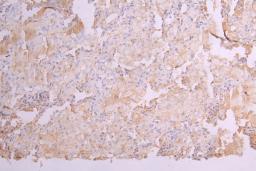 IHC image of CSB-RA012352MA1HU diluted at 1：100 and staining in paraffin-embedded human lung tissue performed on a Leica BondTM system. After dewaxing and hydration, antigen retrieval was mediated by high pressure in a citrate buffer (pH 6.0). Section was blocked with 10% normal goat serum 30min at RT. Then primary antibody (1% BSA) was incubated at 4°C overnight. The primary is detected by a Goat anti-human polymer IgG labeled by HRP and visualized using 0.05% DAB.