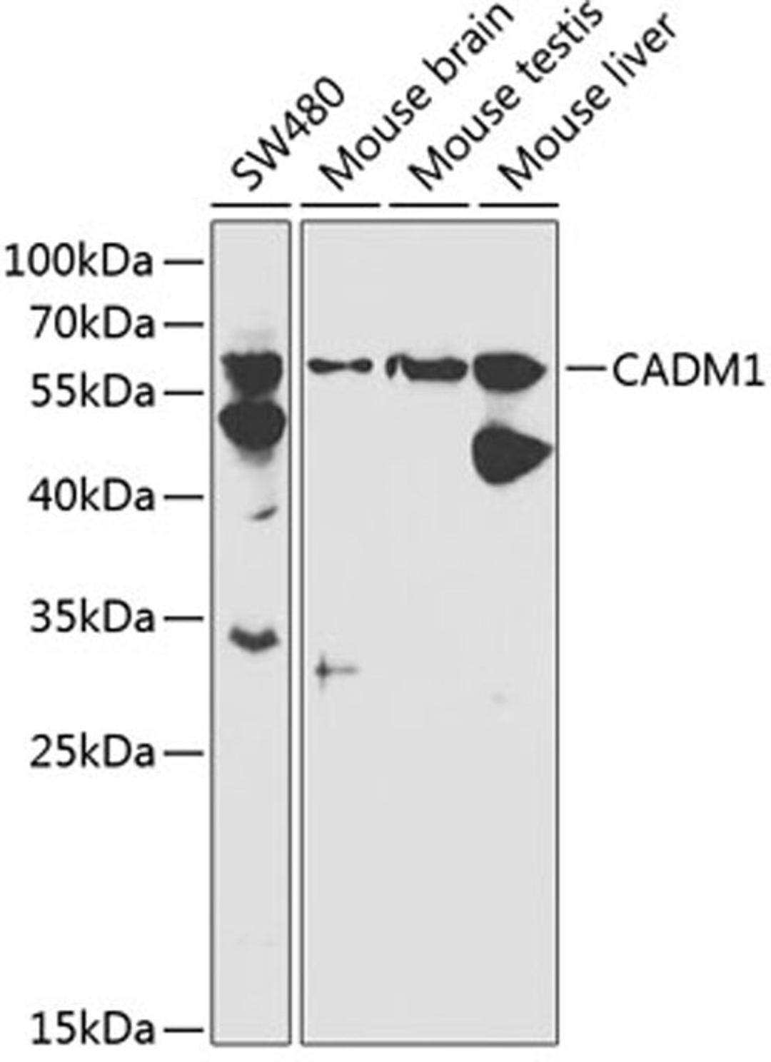 Western blot - CADM1 antibody (A1892)