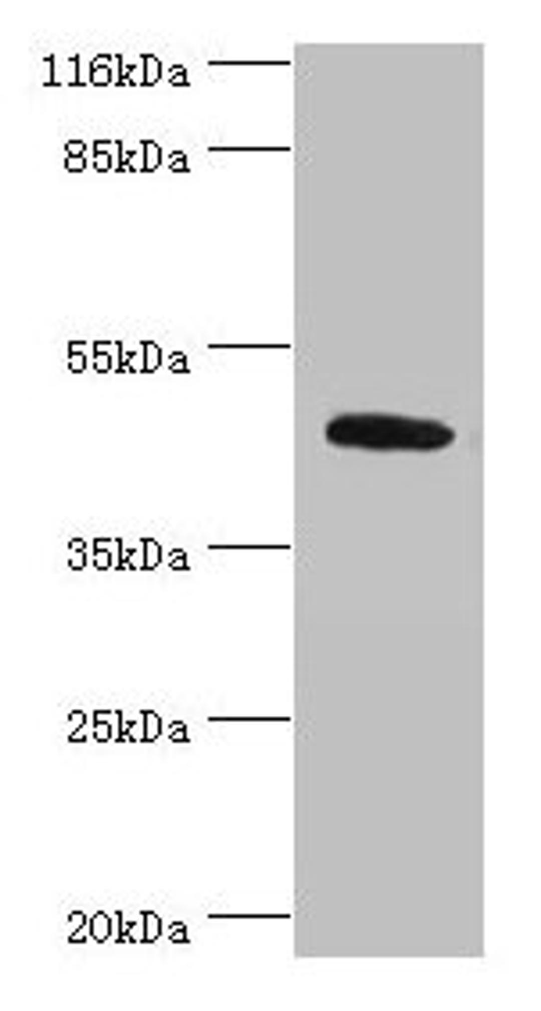 Western blot. All lanes: ATG4A antibody at 2µg/ml + Mouse brain tissue. Secondary. Goat polyclonal to rabbit IgG at 1/10000 dilution. Predicted band size: 46, 39, 37, 43 kDa. Observed band size: 46 kDa