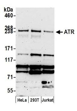 Detection of human ATR by western blot.