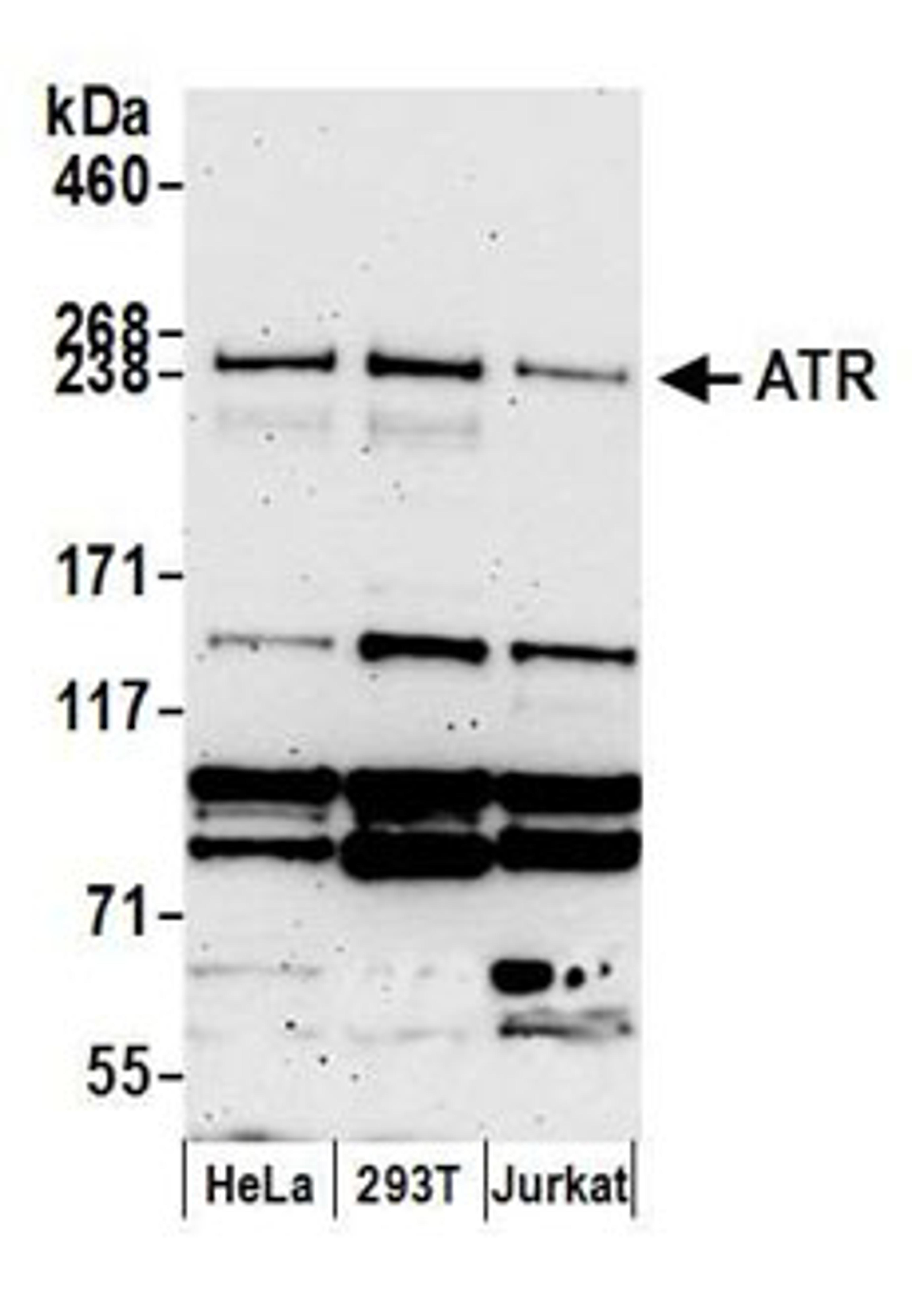 Detection of human ATR by western blot.