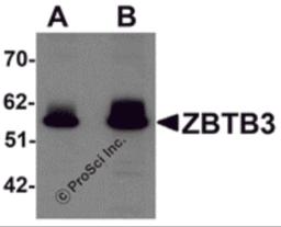 Western blot analysis of ZBTB3 in rat brain tissue lysate with ZBTB3 antibody at (A) 1 and (B) 2 &#956;g/mL.