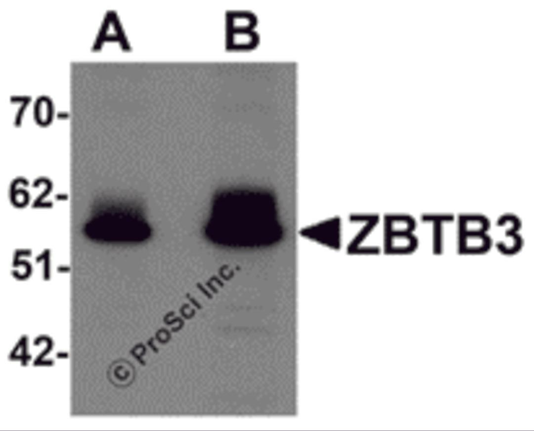 Western blot analysis of ZBTB3 in rat brain tissue lysate with ZBTB3 antibody at (A) 1 and (B) 2 μg/mL.