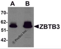 Western blot analysis of ZBTB3 in rat brain tissue lysate with ZBTB3 antibody at (A) 1 and (B) 2 μg/mL.