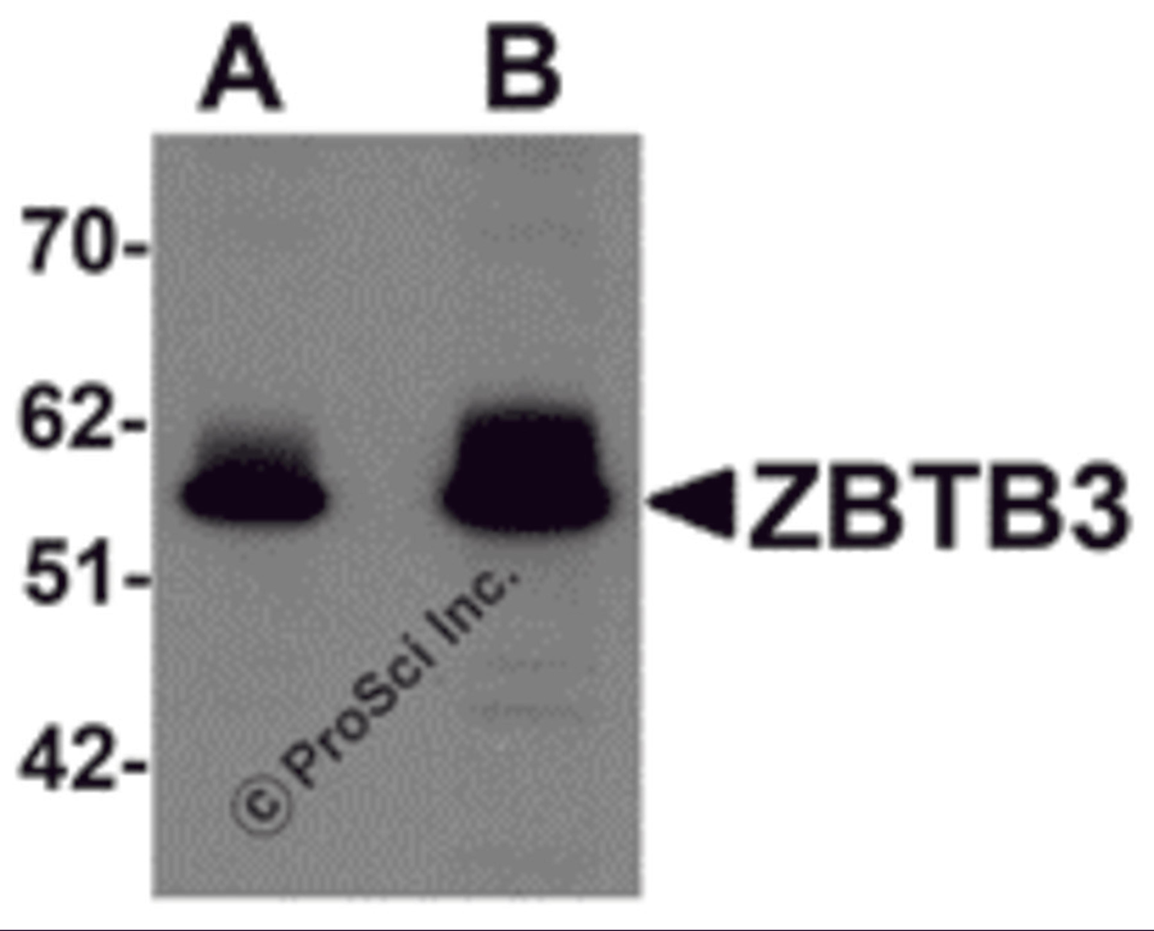 Western blot analysis of ZBTB3 in rat brain tissue lysate with ZBTB3 antibody at (A) 1 and (B) 2 μg/mL.