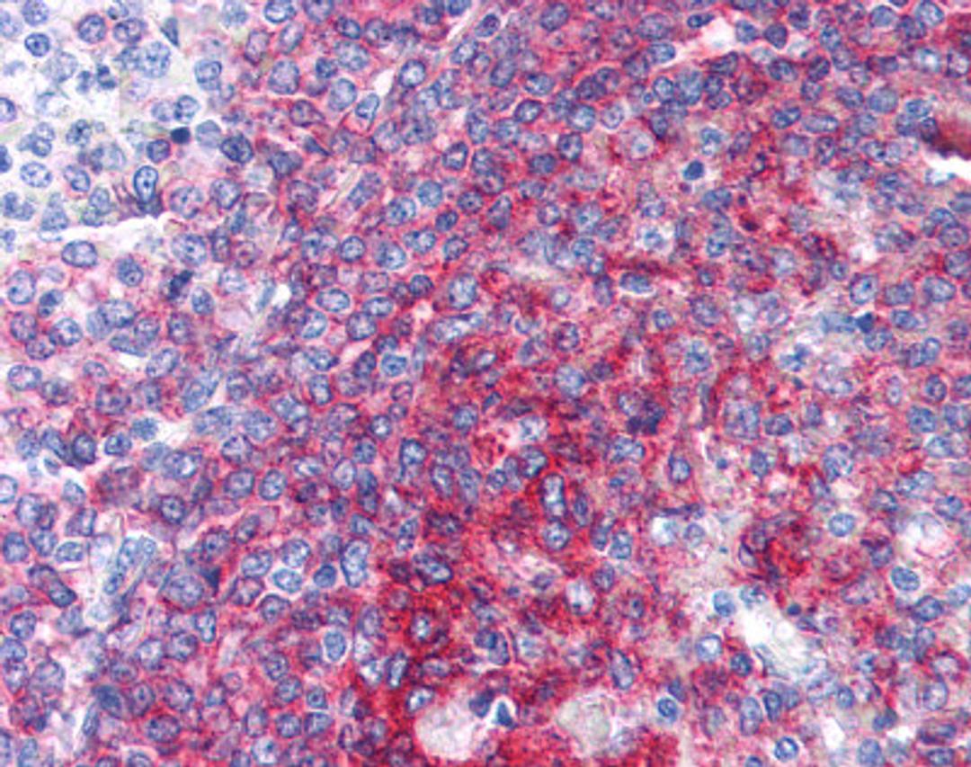 Immunohistochemistry staining of CD40 in spleen tissue using CD40 monoclonal Antibody.